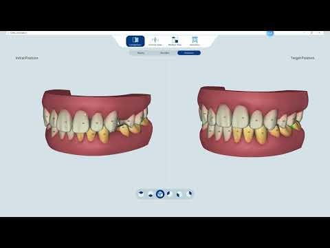 ✨ Orthodontic Simulation with Helios700 ✨