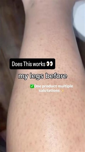 Get rid of strawberry legs and uneven skin ✨🤍 #theordinary #theordinaryreview #skincare #glycolic