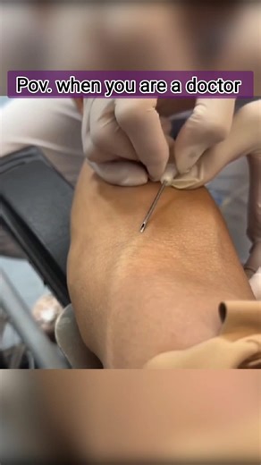 POV: Doctor Finds Vein in One Try 💉 #shorts