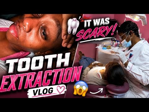 My First Tooth Extraction Experience 😱🦷 | Was It Really That Scary?