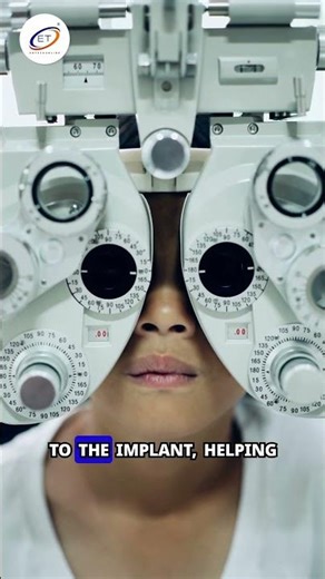 April 15 in science History #BionicEye #MedicalInnovation #VisionRestoration #ENTECH⁣