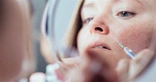 DIY Botox is real and the results range from wonky to catastrophic