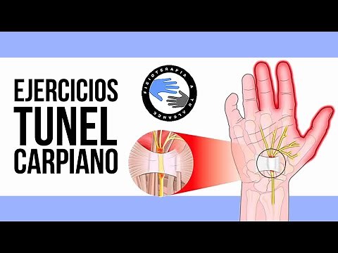 The best exercises for carpal tunnel syndrome