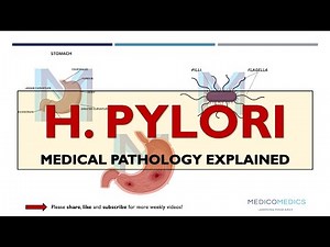 Helicobacter pylori (H. pylori) | Pathophysiology, Symptoms, Diagnosis & Treatment