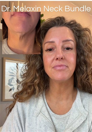 Tech neck. Crepey skin. Horizontal lines. Nobody warned us the neck would age this fast. This Dr. MELAXIN neck bundle is what I use to smooth, firm, and keep everything matching my face. Because we are NOT spending money on good skincare just to forget the neck. It’s in my TikTok Shop. @Dr Melaxin Official #drmelaxin #matureskincare #neckcare #saggyneck #turkeyneck