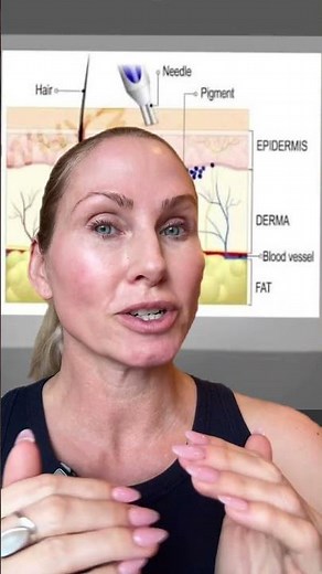 this is an excellent question! Microneedling g won’t hurt your tattoo unless you are going very