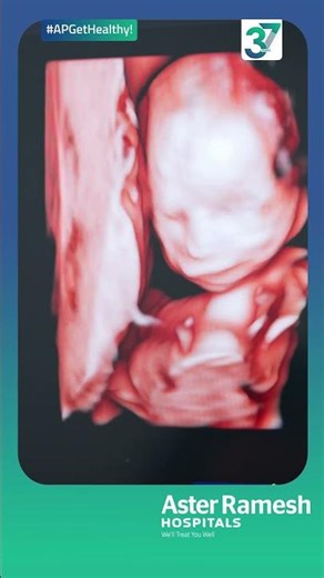 Fetal Echocardiography: What It Is & When You Need It | Dr. R. Jyothi Prakash Reddy Explains