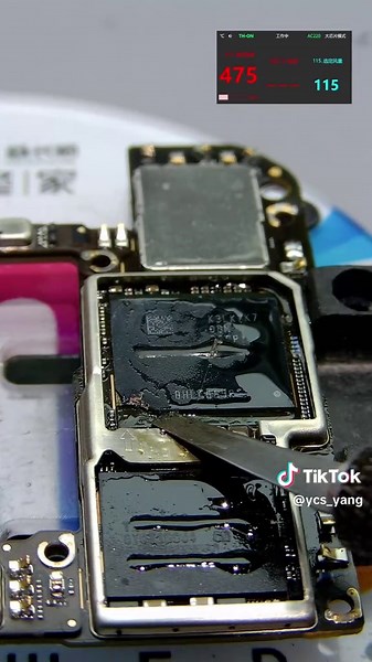 Understanding Memory Loss After Being Hit by a Car