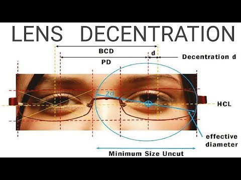 Lens Decentration | AK Khurana | Dr Saud Javed
