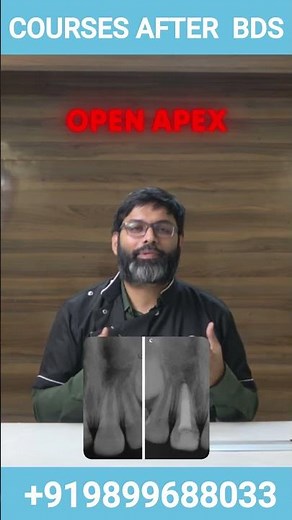 WHAT IS MINERAL TRIOXIDE AGGREGATE ( MTA ) ? #apexification #mtaplus #mta