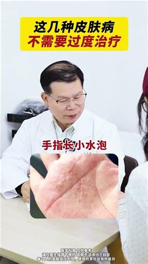 Quick Fixes for Common Skin Issues - 30-Second Solutions for Busy Lives