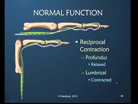 Insight into the Lumbrical Muscle & Testing for Tightness Preview