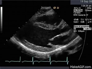 Normal Echo on Make a GIF