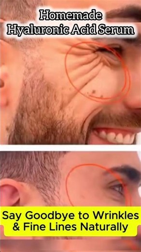 Homemade hyaluronic acid serum😍#hyaluronicacid#faceserum #brightskin #wrinkles #shortviral#viralreel