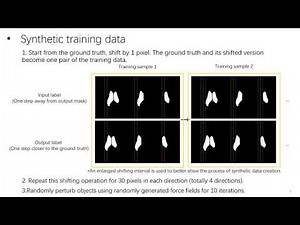 Label super resolution for 3D Magnetic Resonance Images using Deformable U-net | SPIE 2021