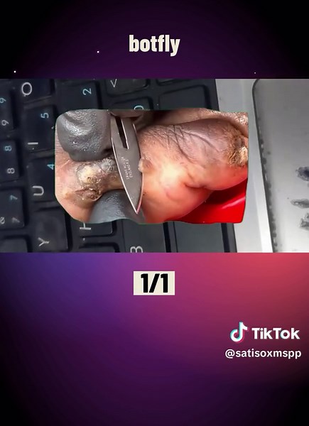 botfly #botfly #satisfyingvideoviral