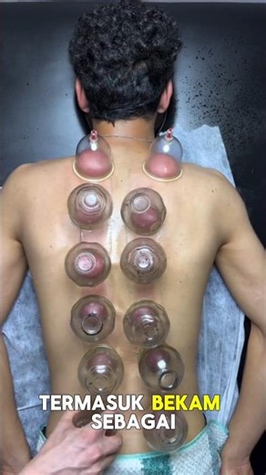 Rahasia Bekam! Pengobatan Kuno Sejak 1500 SM 😱
