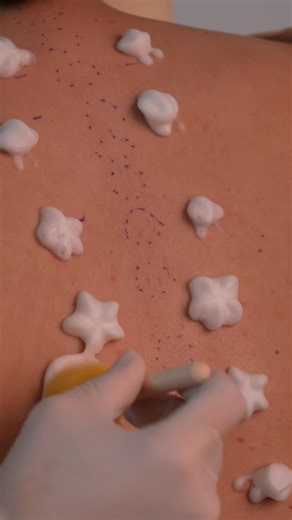 84K views · 915 reactions | ASMR Back Exam | Soft-Spoken Inspection, Spine Check, Touch Sensitivity & Relaxing Triggers #spinealignement #backexam #relaxing #asmrrealperson #ivybasmr #asmrrelax #asmr #chiropractic #relaxtok #asmrtok | Ivy B ASMR | Facebook