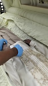 618K views · 4.4K reactions | Resulta ng soft embalming 17days binurol #angembalsamador | Ang Embalsamador | Facebook