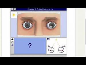 Simulador de Hirschberg