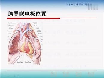 心电图视频教程导联电极位置