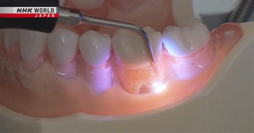 Dental Breakthroughs To Save Your Smile - Medical Frontiers