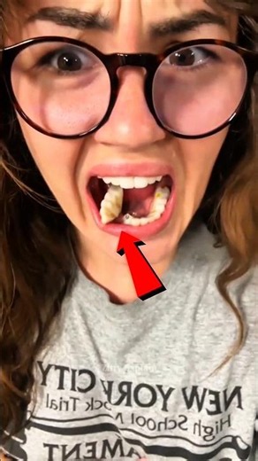 She Broke a Tooth While Brushing 🤯