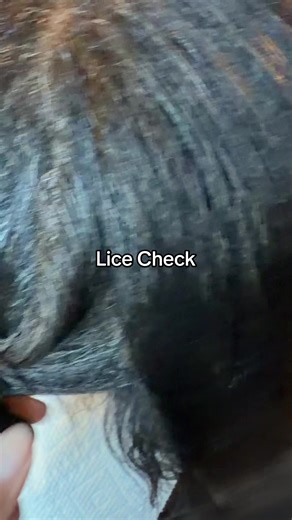 Professional Lice Removal Services in Atlanta, Georgia