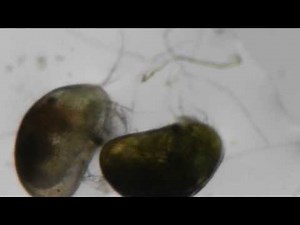 Ostracod, live, under the scope.