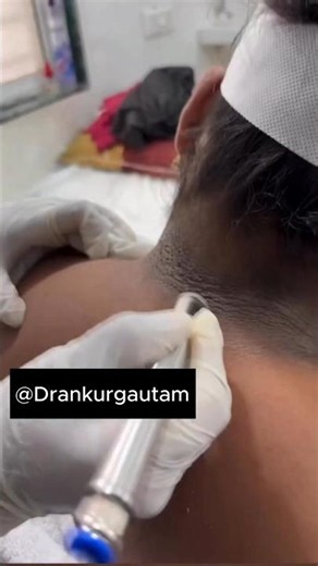 Dark neck making you feel conscious? 👀 #DarkNeck #NeckPigmentation #Hyperpigmentation