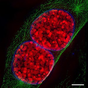 Quelle est la difference entre prophase et metaphase - Nouvelles 2026