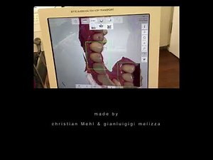 Full mouth reconstruction and testing the new Trios Scanner - // Case of the Month