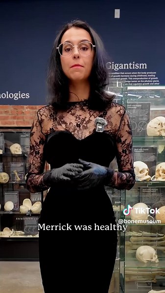 Joseph Merrick, historically known as the “Elephant Man,” developed dramatic skeletal changes from what is now believed to have been Proteus syndrome. His case became an important part of the study of abnormal bone growth. Discover his story alongside our new exhibit on Leontiasis Ossea, featuring a remarkable 19th-century skull that helped shape our understanding of skeletal disease. Tickets available now! #bonetok #learnontiktok #edutok #learnontiktokcontest