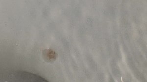 1.4M views · 2.5K reactions | Peed out | Parasite Purger | Facebook