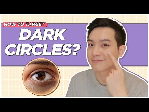 How to address DARK UNDEREYE CIRCLES? Causes + Products to Use! (Filipino) | Jan Angelo
