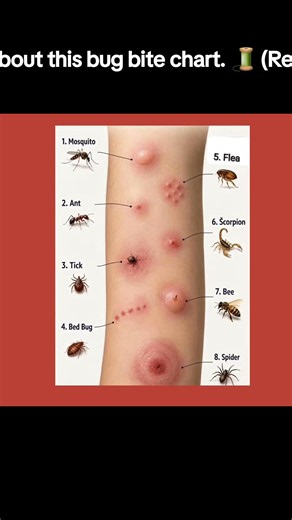 Real talk about this bug bite chart. 🧵 (Read Below)