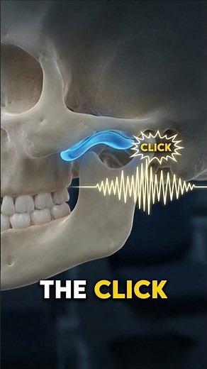Why Your Jaw Clicks 💀 (TMJ Explained)