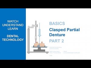 Clasped anchored partial denture | Part 2