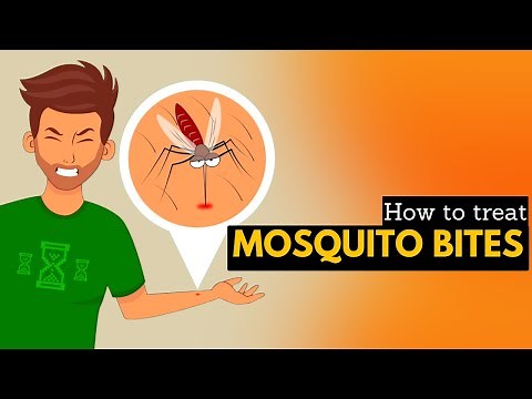 How To Treat Mosquito Bites.