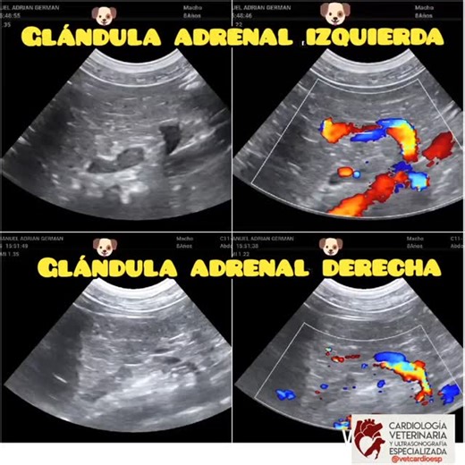 Glándulas adrenales en perro, modo B y Doppler color. https://www.instagram.com/vetcardioesp/ #cardiologiaveterinaria #vetcardiology #vetmed #mindray #vetus #vetusE7 #veterinary #vet #vetlife #vetschool #veterinario #medicinaveterinaria #ecocardio #echocardio #ultrasonido #ultrasonidoveterinario #veterinarioqueretaro #vetqro #vetmexico | Cardiología Veterinaria y Ultrasonografía Especializada