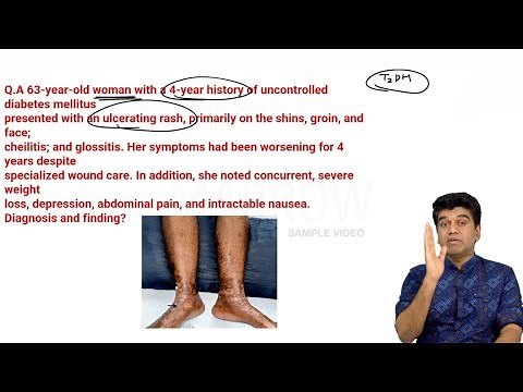 Marrow Edition 8 Revision Videos: Medicine (Integrated) Sample Video