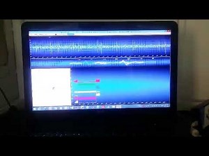 Single Unit recording (spike)