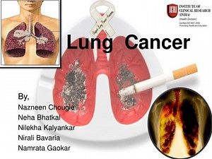 Lung Cancer - SlideServe