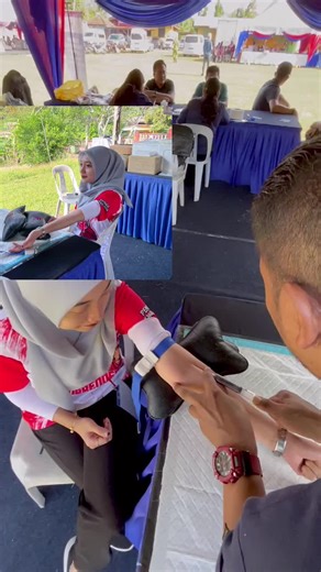 Arm Measurement and Casting Demonstration