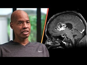 Jason Collins, Former NBA Star, Reveals Stage 4 Brain Cancer