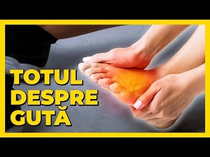 What is gout?❓Gout foot treatment❗Gout symptoms
