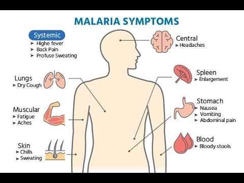 Signs and Symptoms of uncomplicated Malaria