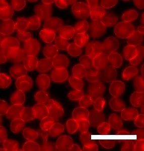Lipid bilayer characterization - Alchetron, the free social encyclopedia