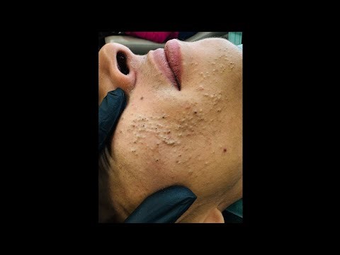 First Time Getting a Facial – What Really Happens?