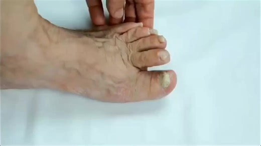 Nano Defense Pro: Elimina hongos y mejora tus uñas